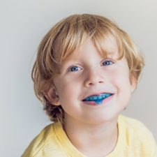 Why Are Mouthguards Important for Your Teeth?